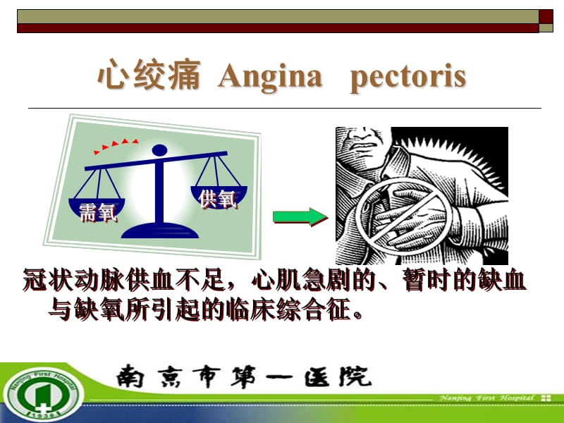 心绞痛的最新分型,心绞痛的最新分型,观点阐述