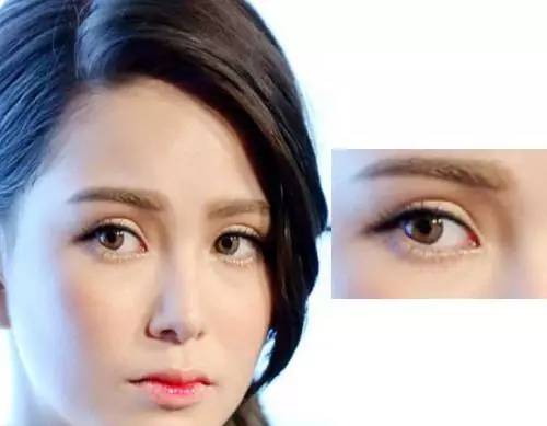 明星双眼皮背后的美丽秘密与故事揭秘